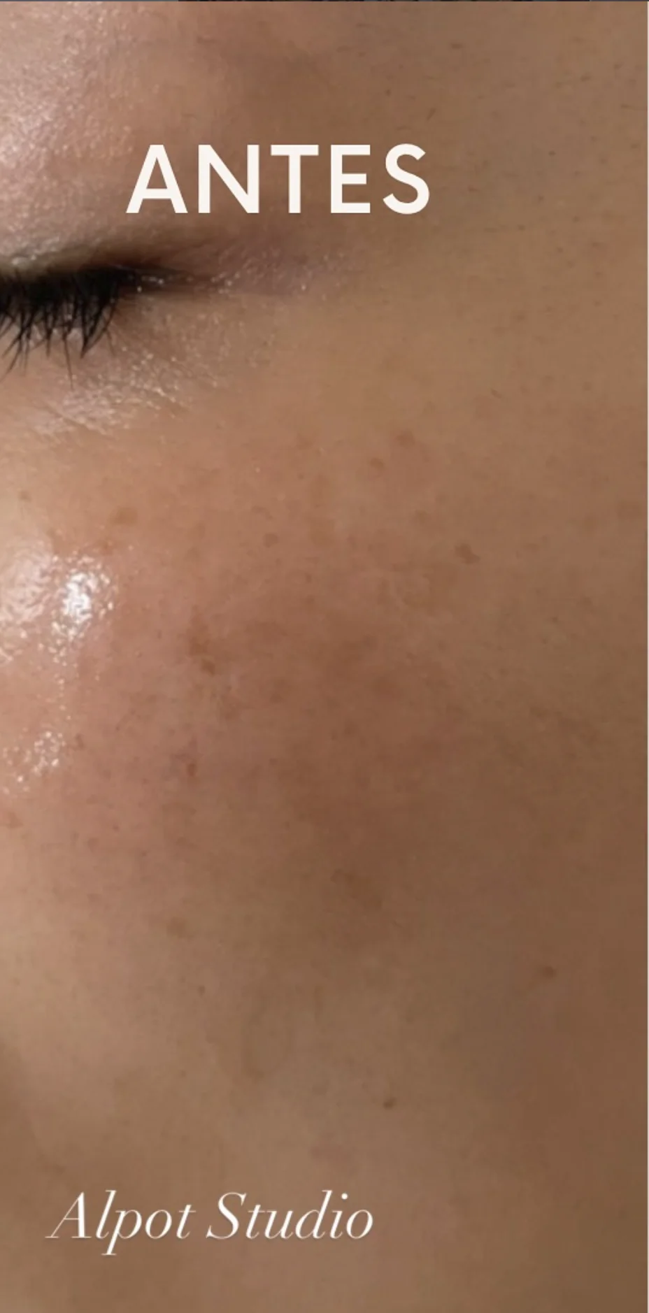 Tratamiento Facial — antes