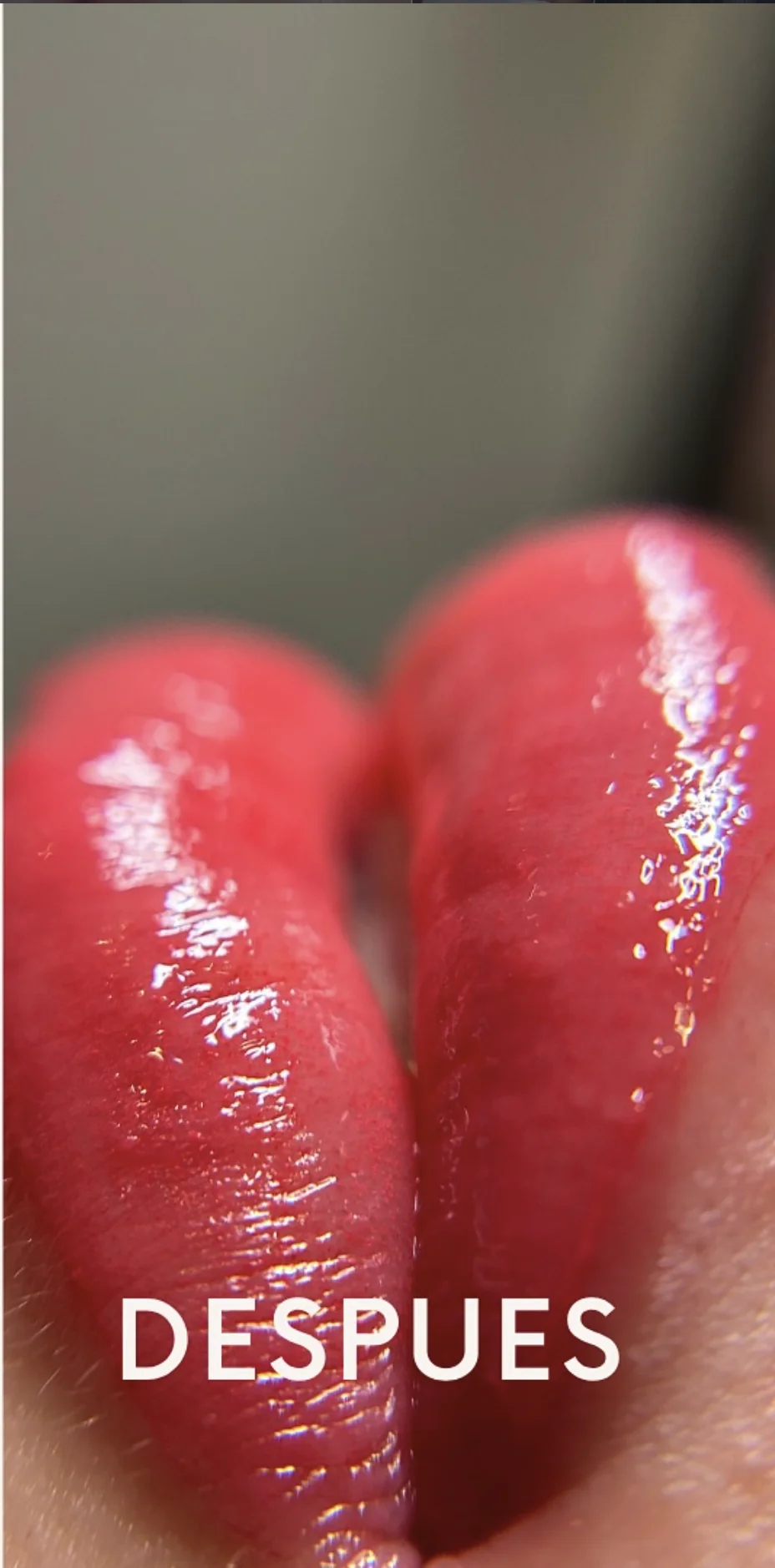 Tratamiento de Labios