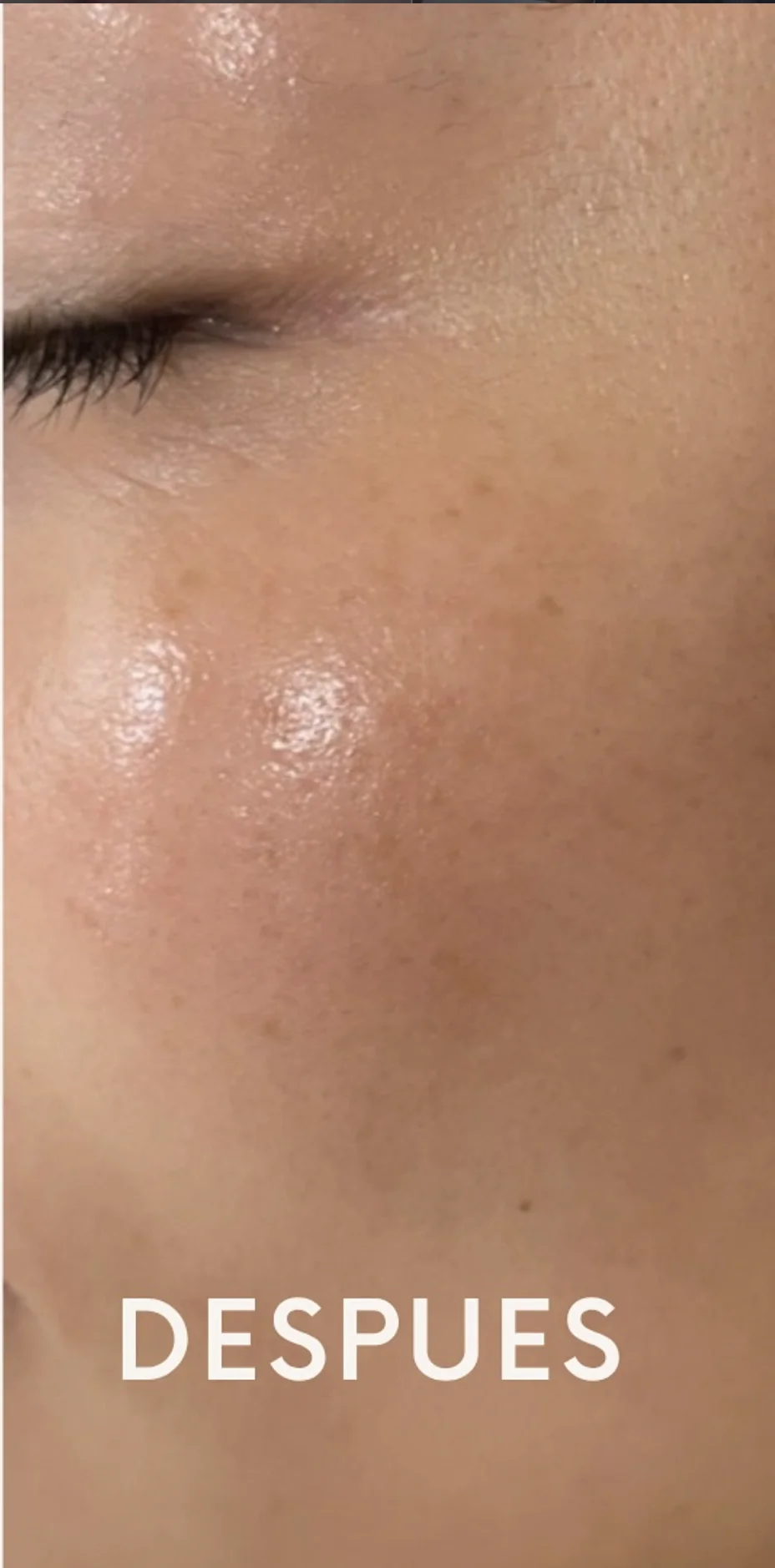 Tratamiento Facial