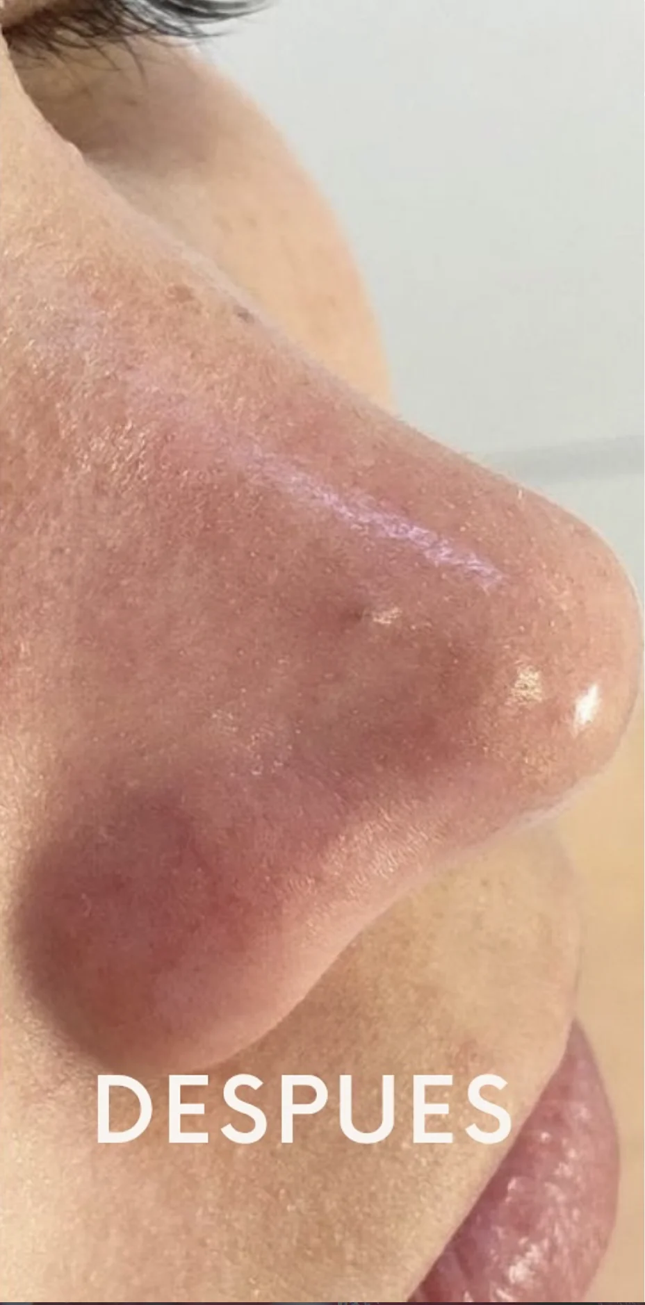 Limpieza Facial Profunda
