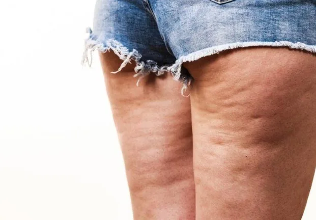 Celulitis — tratamiento facial Alpot Studio
