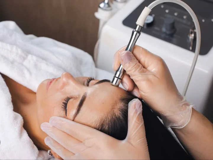 Microdermobrasion — tratamiento facial Alpot Studio