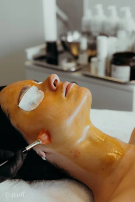 Peeling Quimico — tratamiento facial Alpot Studio