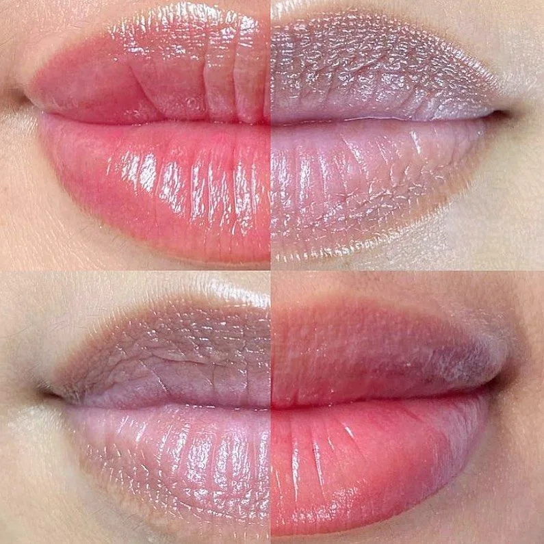 Neutralizacion Labios — Línea Harmony Alpot Studio